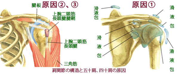 五十肩・四十肩の原因とメカニズム