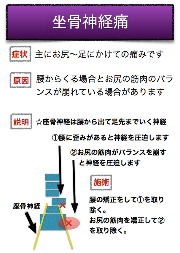 坐骨神経痛の原因・症状・施術方法