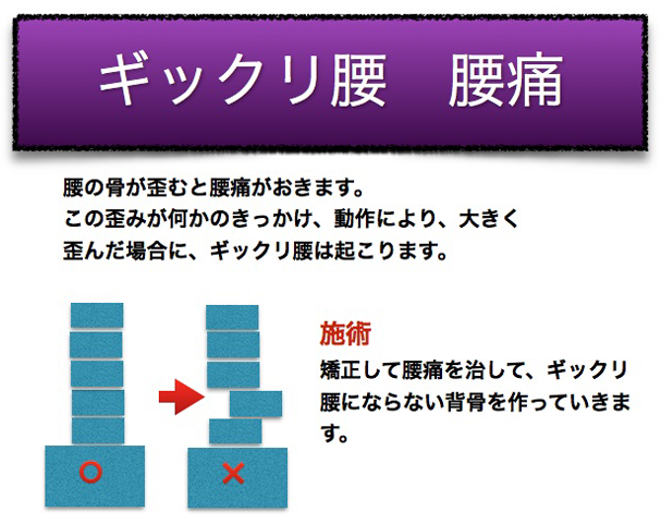 腰痛の原因と施術方法